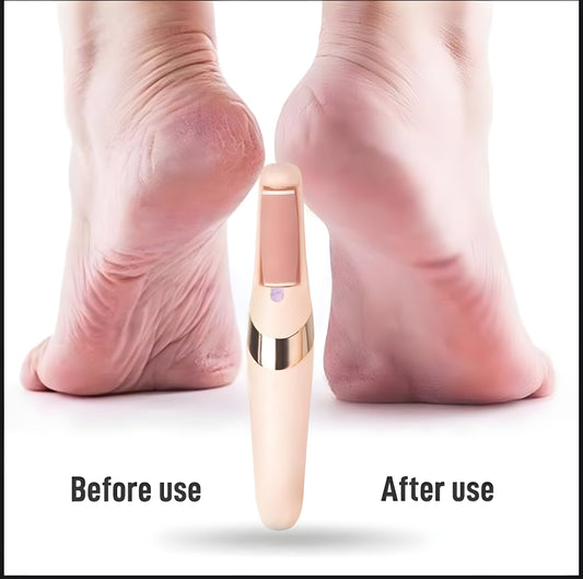 •Rechargeable Electric Foot File Callus Remover Pedicure Machine•
